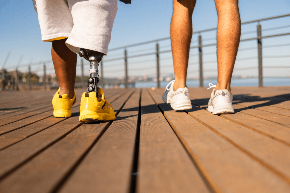 Two people walking on a boardwalk one with a prosthetic leg - The Law Offices Of Justin Frankel